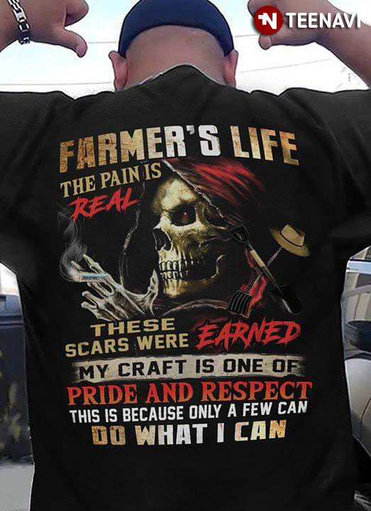 Farmer's Life The Pain Is Real These Scars Were Earned My Craft Is One Of Pride And Respect