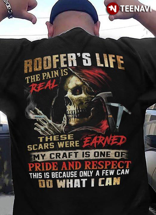 Roofer's Life The Pain Is Real These Scars Were Earned My Craft Is One Of Pride And Respect