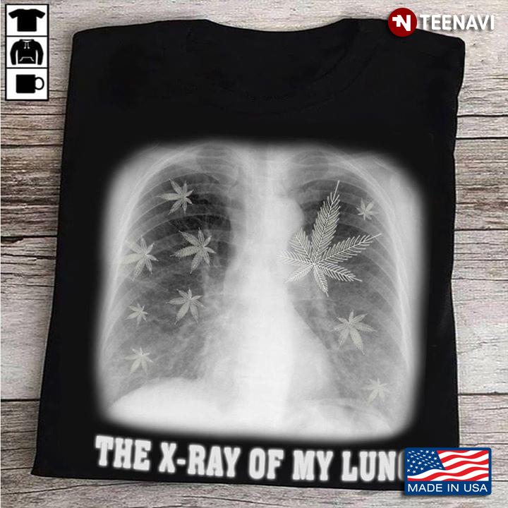 The X-Ray Of My Lung Weed
