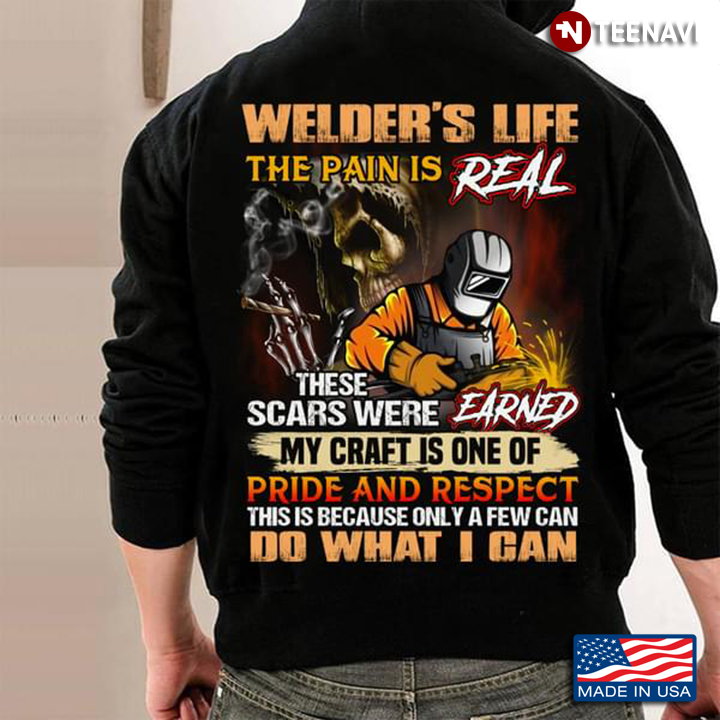 Welder’s Life The Pain Is Real These Scars Were Earned My Craft Is One Of Pride
