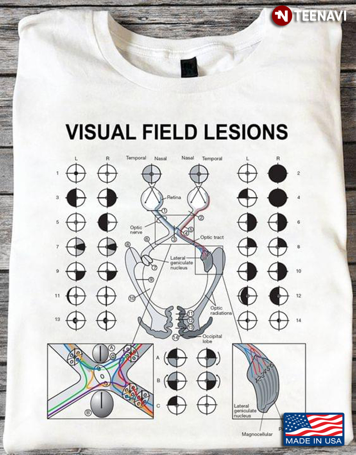 Visual Field Lesions