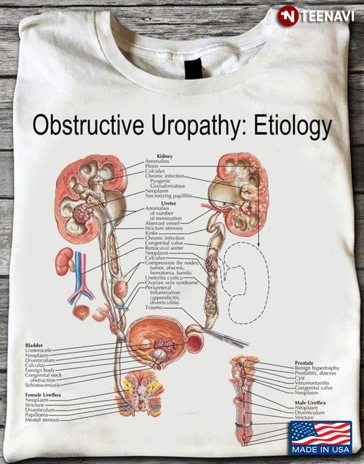 Obstructive Uropathy: Etiology Urinary Kidney for Science Lovers