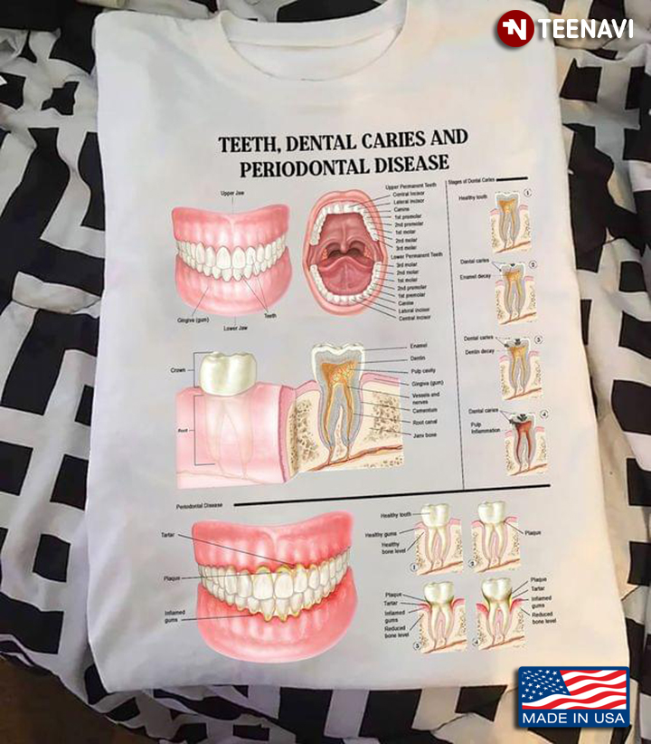 Teeth Dental Caries And Periodontal Disease