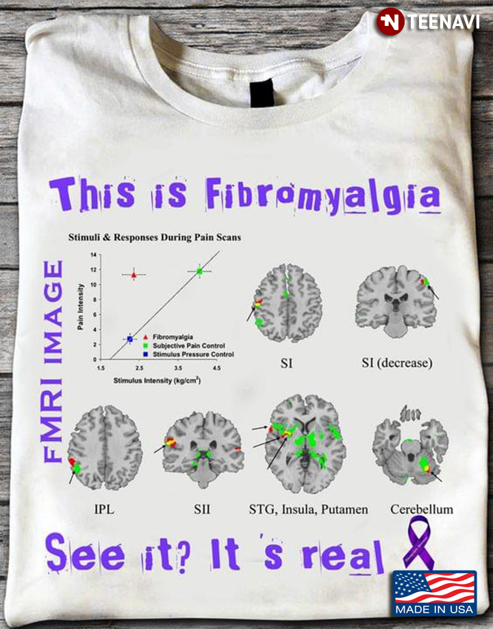 This Is Fibromyalgia FMRI Image See It It's Real Fibromyalgia Awareness