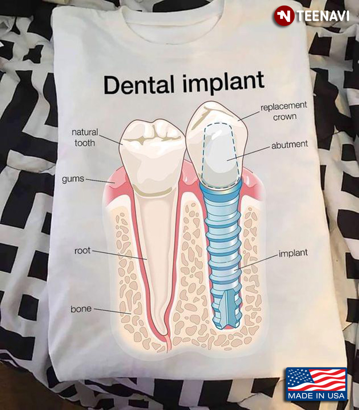 Dental Implant Teeth Gifts for Dentist