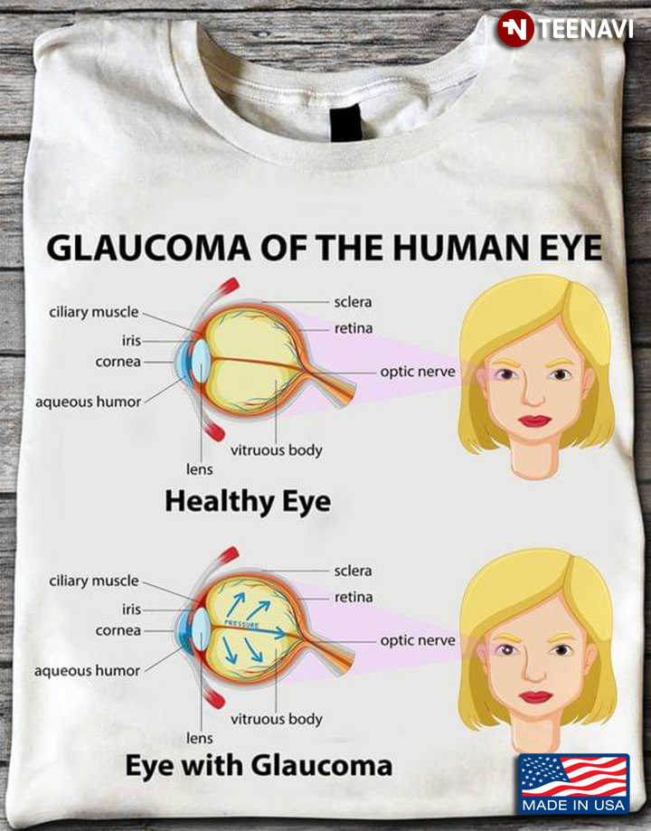 Glaucoma Of The Human Eye