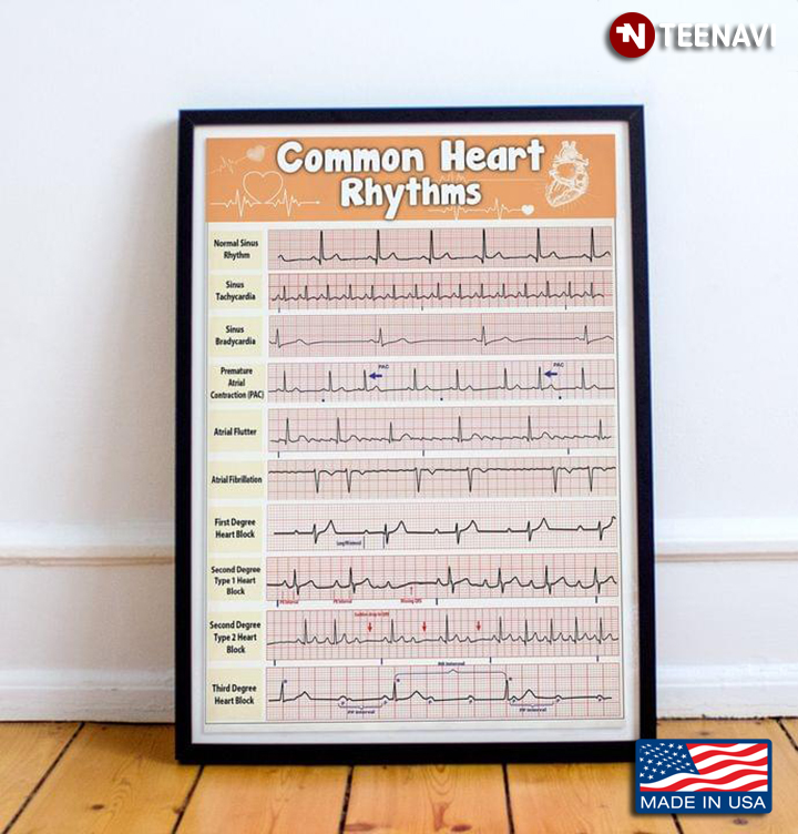 Common Heart Rhythms